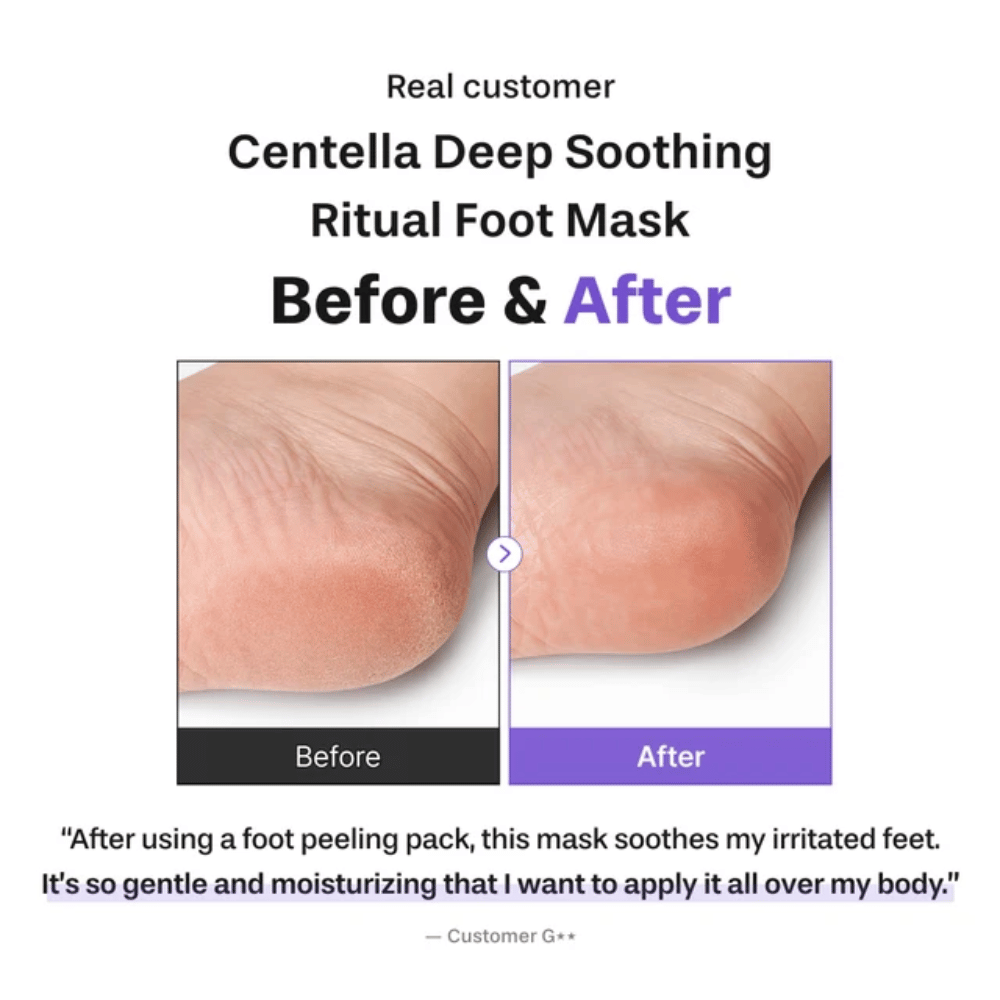 6. Baren Centella Deep Soothing Ritual Foot Mask – imagem de antes e depois que mostra um calcanhar mais macio e mais hidratado após a utilização