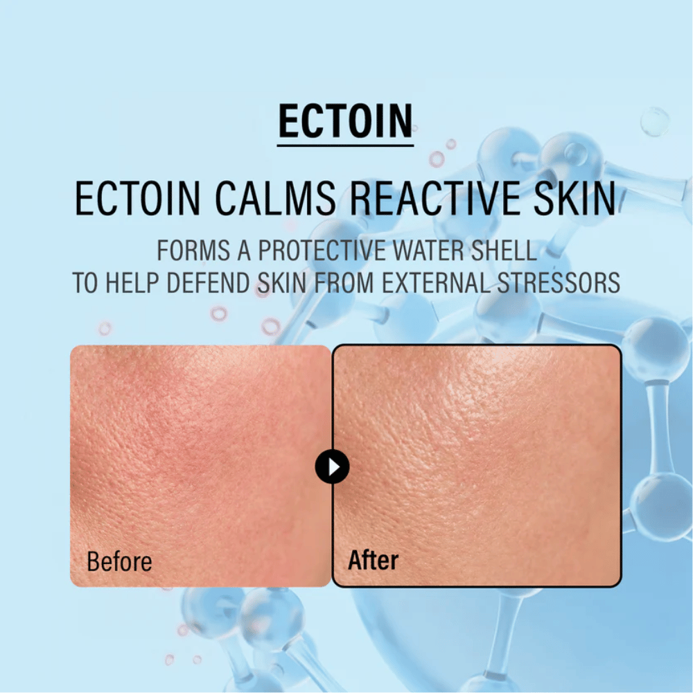 EPII Double Up Cream com ectoína que acalma a pele sensível, protege contra agressões externas e reforça a barreira natural da pele.