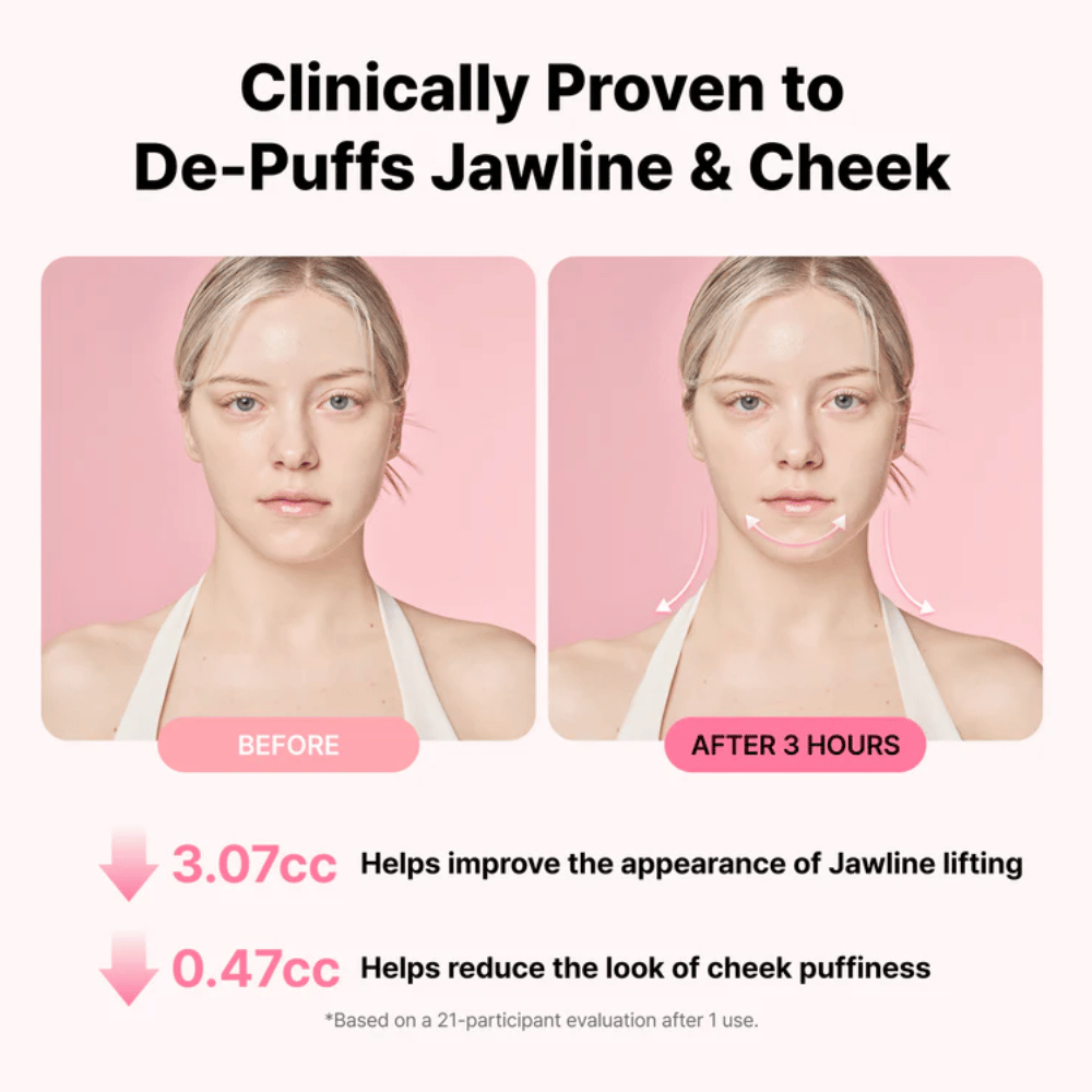 Imagem de antes e depois que ilustra a melhoria do aspeto da linha do maxilar e a redução do inchaço após a utilização de RETURNITY Ear Therapy Acupressure Patch durante três horas.