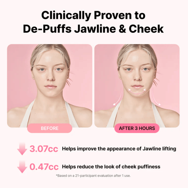 Imagem de antes e depois que ilustra a melhoria do aspeto da linha do maxilar e a redução do inchaço após a utilização de RETURNITY Ear Therapy Acupressure Patch durante três horas.