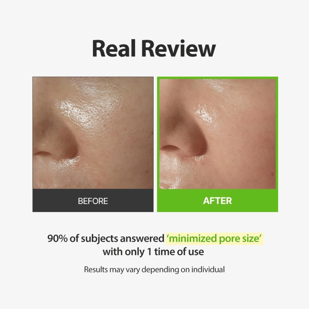 SUNGBOON EDITOR Green Tomato Pore Peeling Jumbo Pad – imagem de antes e depois com foco nos poros visíveis
