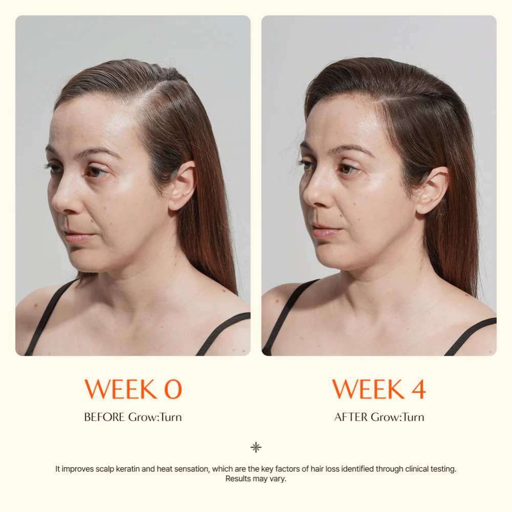Imagem de antes e depois de uma mulher (semana 0 vs semana 4) que mostra melhoria na qualidade do cabelo e uma sensação mais cheia após a utilização.