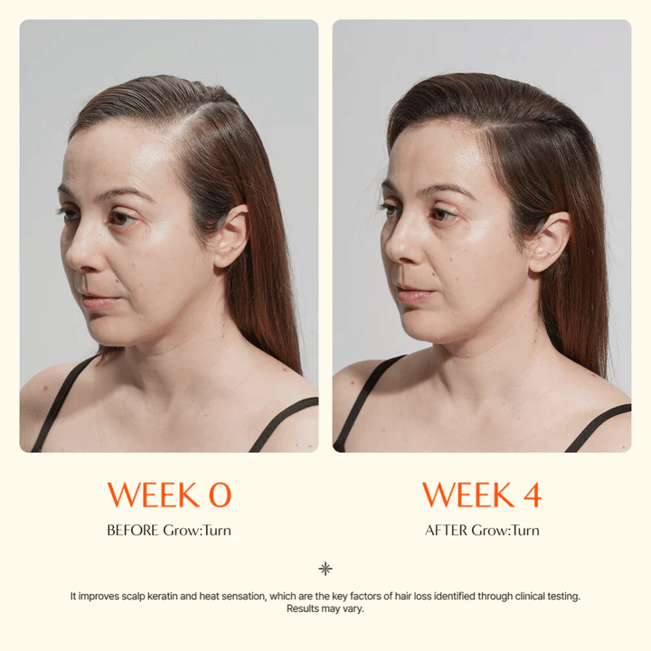 Imagem de antes e depois de uma mulher (semana 0 vs semana 4) que mostra melhoria na qualidade do cabelo e uma sensação mais cheia após a utilização.