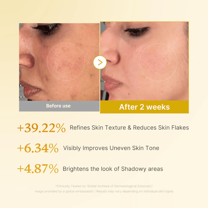 Imagem de antes e depois para Medicube Kojic Acid Turmeric Resurfacing Toner que mostra melhoria da textura da pele, tom de pele mais uniforme e redução de escamas secas na pele após duas semanas de utilização.