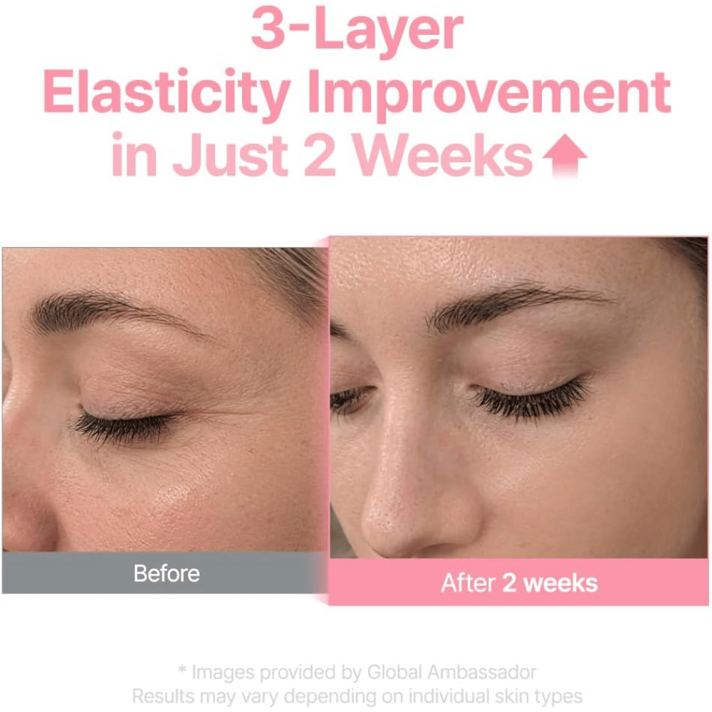 Imagem de antes e depois de Purito Multi PDRN Collagen EGF Serum que mostra uma melhoria da elasticidade da pele após duas semanas.
