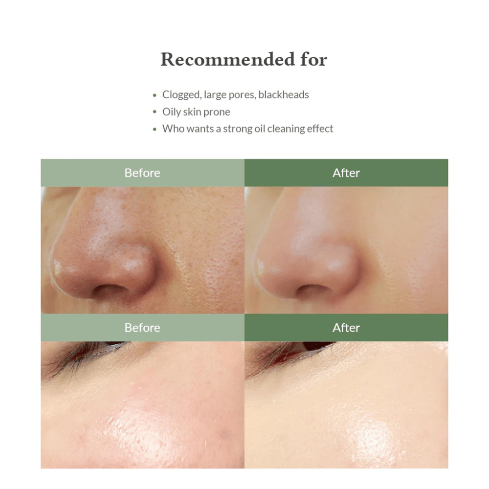 Dr. Althea Premium Quick Step Sebum Cleanser – limpeza facial que ajuda a reduzir cravos, limpar poros profundamente e proporcionar uma textura de pele mais uniforme.